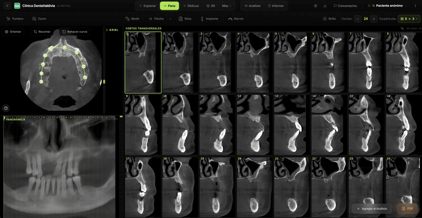 Implantology