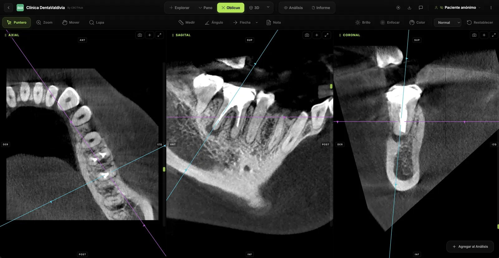 Endodontics